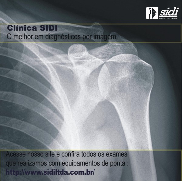 card sidi raio x.jpg